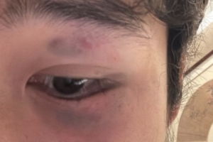 都灵罗马免费直播