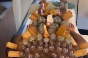 神秘力量加持！30岁奥纳纳全身拔罐疗伤，从肩膀到小腿布满罐印